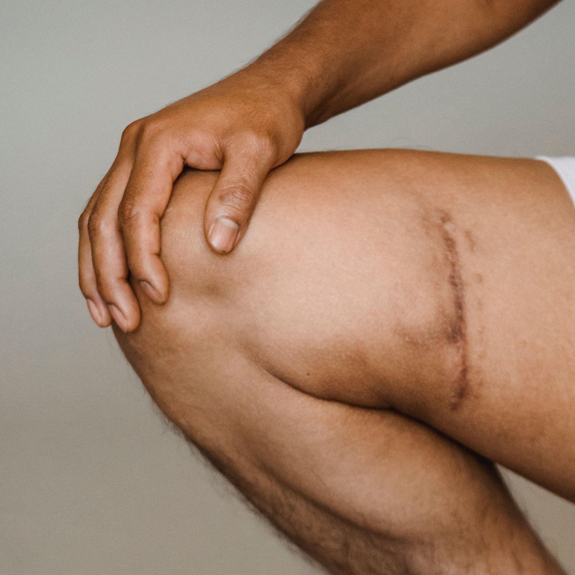 Wound and scar healing