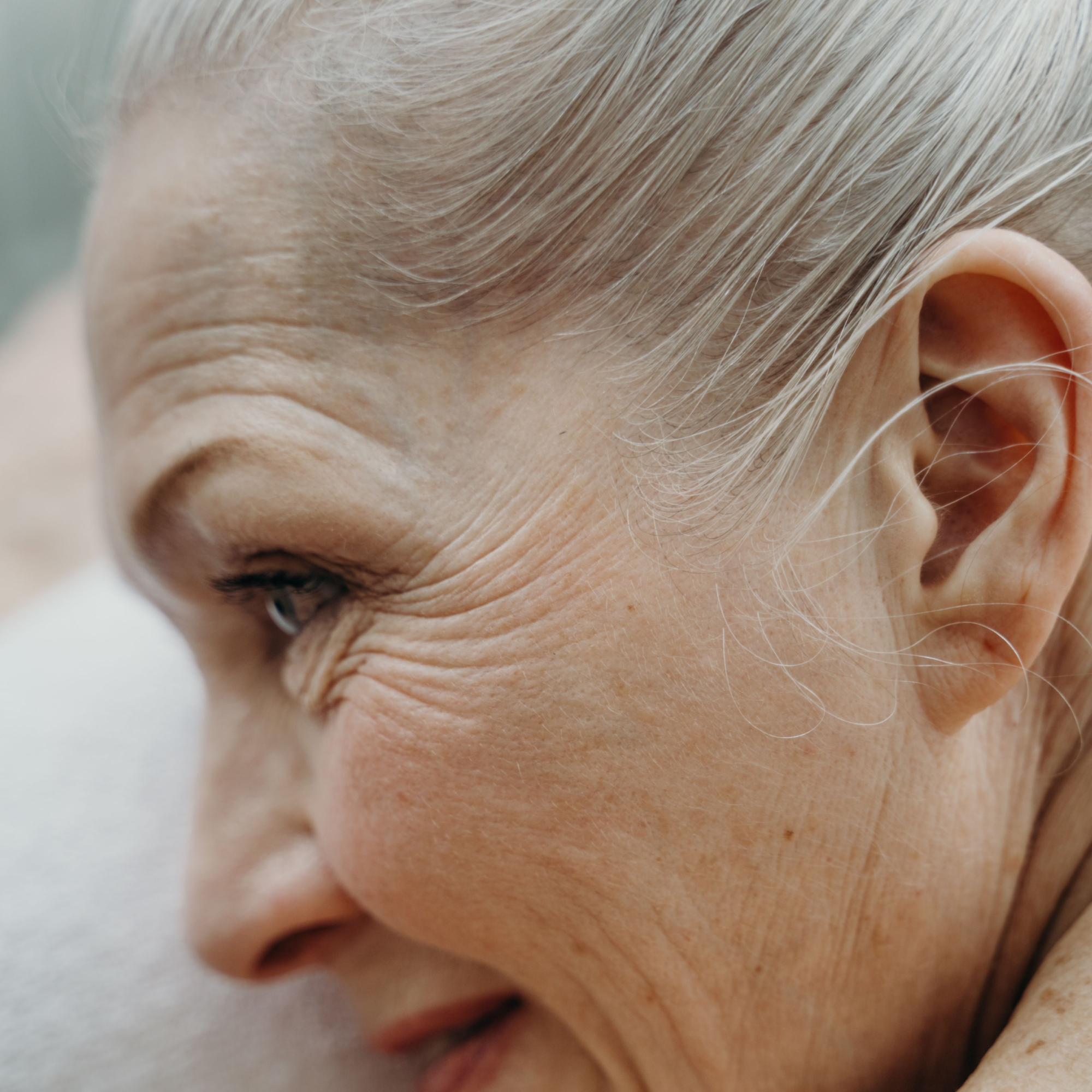 Facial laxity