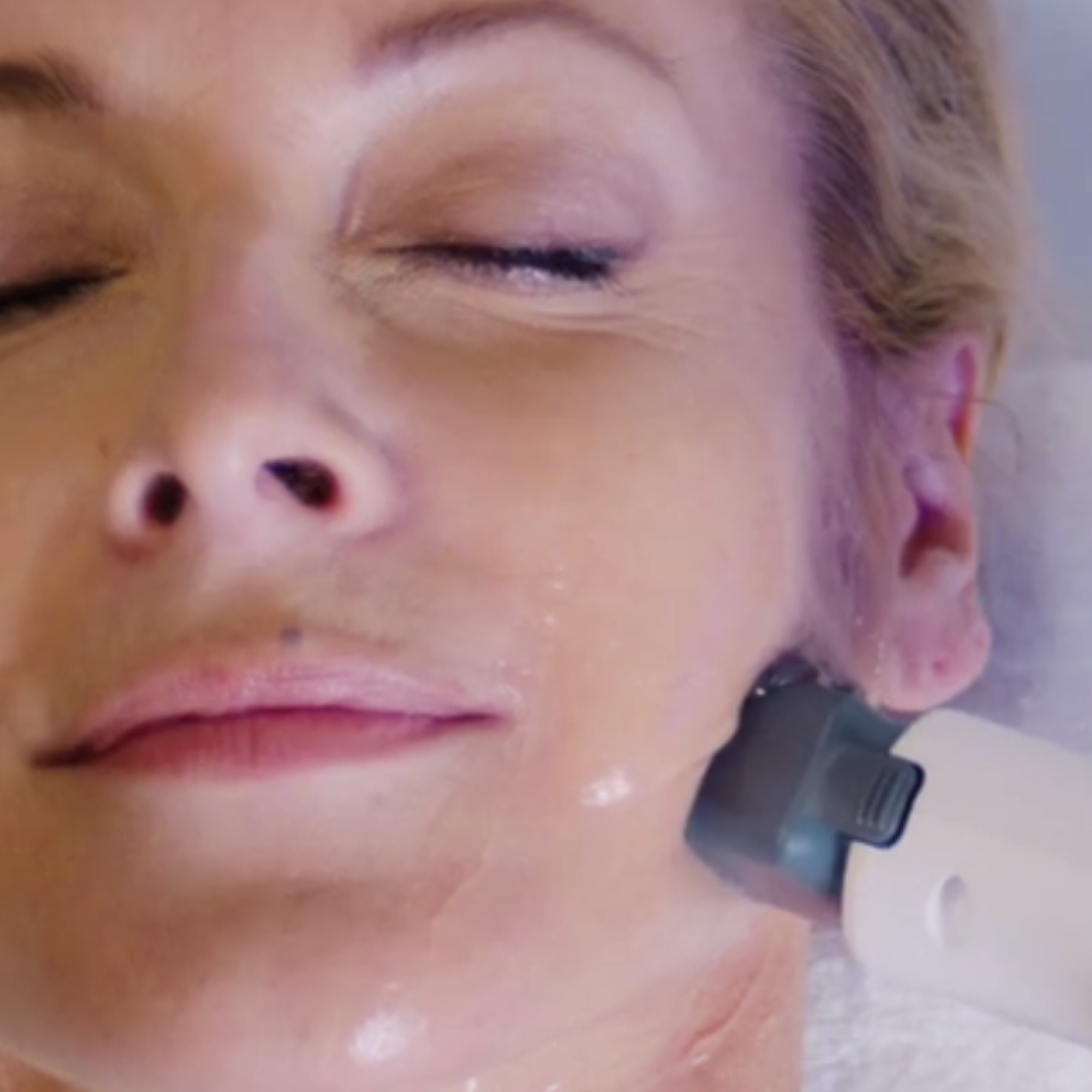 Neck laxity